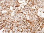 mGluR6 Antibody in Immunohistochemistry (Paraffin) (IHC (P))