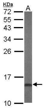 DUSP23 Antibody in Western Blot (WB)