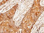 ROCK2 Antibody in Immunohistochemistry (Paraffin) (IHC (P))