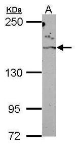 ROCK2 Antibody in Western Blot (WB)