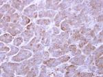 ARL1 Antibody in Immunohistochemistry (Paraffin) (IHC (P))