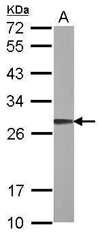 ARL1 Antibody in Western Blot (WB)