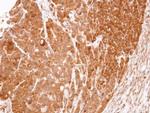 eRF1 Antibody in Immunohistochemistry (Paraffin) (IHC (P))