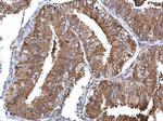 NME1 Antibody in Immunohistochemistry (Paraffin) (IHC (P))