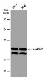 NME1 Antibody in Western Blot (WB)