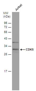 CDK5 Antibody in Western Blot (WB)