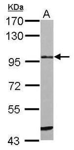 ST14 Antibody in Western Blot (WB)