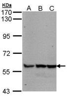 GDF5 Antibody in Western Blot (WB)