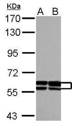 GDF5 Antibody in Western Blot (WB)