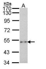 P2X2 Antibody in Western Blot (WB)