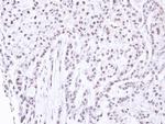 PNK Antibody in Immunohistochemistry (Paraffin) (IHC (P))