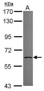 PNK Antibody in Western Blot (WB)