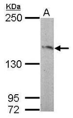 RASGRF2 Antibody in Western Blot (WB)