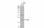 N-Ras Antibody in Western Blot (WB)