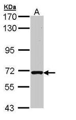 RASGRP2 Antibody in Western Blot (WB)