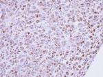 MINPP1 Antibody in Immunohistochemistry (Paraffin) (IHC (P))