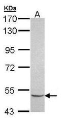 MINPP1 Antibody in Western Blot (WB)