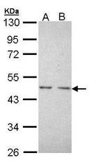 TR2 Antibody in Western Blot (WB)