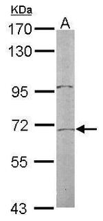 TR2 Antibody in Western Blot (WB)