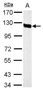 CD146 Antibody in Western Blot (WB)