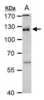 CD146 Antibody in Western Blot (WB)