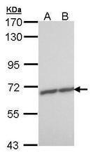 ZNF223 Antibody in Western Blot (WB)