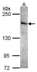 STK36 Antibody in Western Blot (WB)