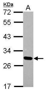 DLX1 Antibody in Western Blot (WB)