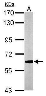 CACNB1 Antibody in Western Blot (WB)