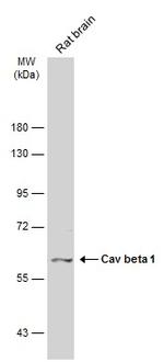 CACNB1 Antibody in Western Blot (WB)