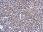 Bestrophin 1 Antibody in Immunohistochemistry (Paraffin) (IHC (P))