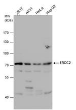 XPD Antibody in Western Blot (WB)