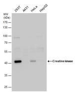 Creatine Kinase MB Antibody in Western Blot (WB)