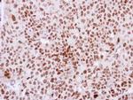 DKC1 Antibody in Immunohistochemistry (Paraffin) (IHC (P))