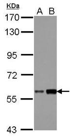 DKC1 Antibody in Western Blot (WB)