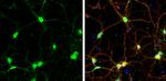 SNAP23 Antibody in Immunocytochemistry (ICC/IF)