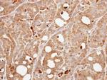 Calcineurin B Antibody in Immunohistochemistry (Paraffin) (IHC (P))