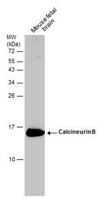 Calcineurin B Antibody in Western Blot (WB)