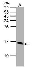 FABP1 Antibody in Western Blot (WB)