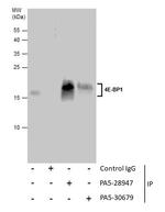 4EBP1 Antibody in Immunoprecipitation (IP)