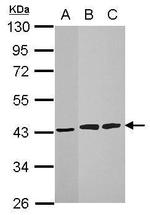 HIBCH Antibody in Western Blot (WB)