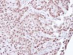 Aprataxin Antibody in Immunohistochemistry (Paraffin) (IHC (P))