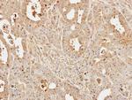 UBE2D1 Antibody in Immunohistochemistry (Paraffin) (IHC (P))