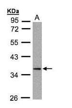 MKP4 Antibody in Western Blot (WB)