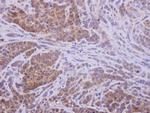 AKR1D1 Antibody in Immunohistochemistry (Paraffin) (IHC (P))