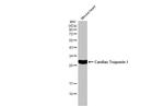 Cardiac Troponin I Antibody in Western Blot (WB)