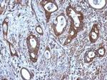 CNDP1 Antibody in Immunohistochemistry (Paraffin) (IHC (P))