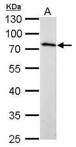 MMP16 Antibody in Western Blot (WB)