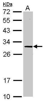 ORNT1 Antibody in Western Blot (WB)