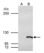 SMARCAL1 Antibody in Immunoprecipitation (IP)